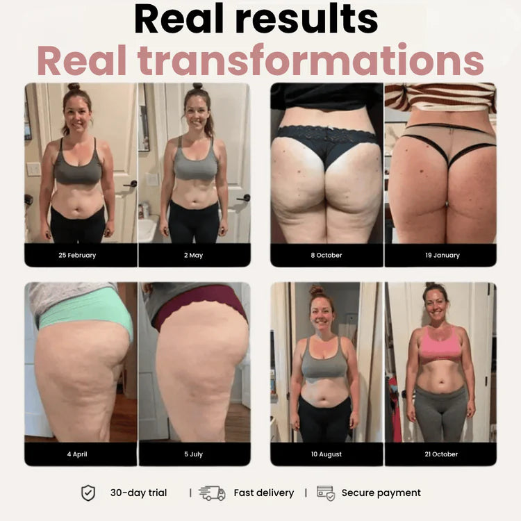 Kila Sculpt™ Anti-Cellulite Compression Legging