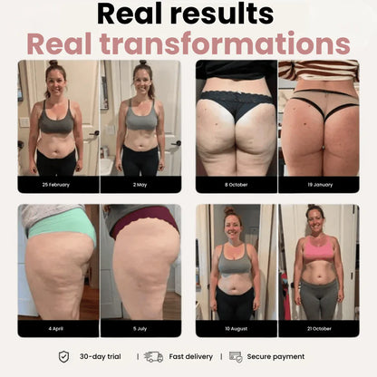 Kila Sculpt™ Anti-Cellulite Compression Legging